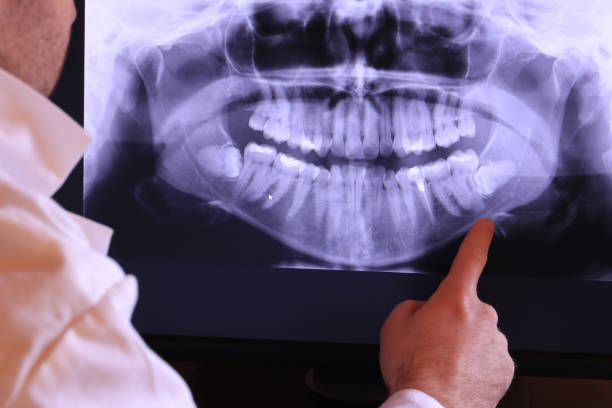 Best Emergency Denture Repair in Fitchburg, MA