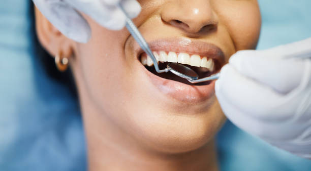 Best Emergency Treatment for Dental Infections or Abscesses in Fitchburg, MA